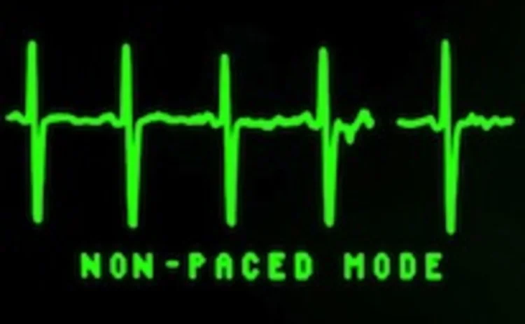 ecg ecg